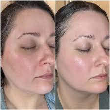 Glow Duo Pack - (3 Mask + 1 Rose Water)